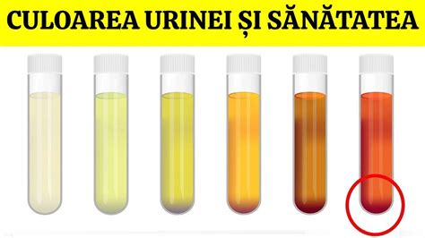 culoarea urinei|Totul despre culoarea urinei